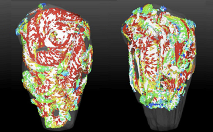 Blood flow analysis in a left ventricle